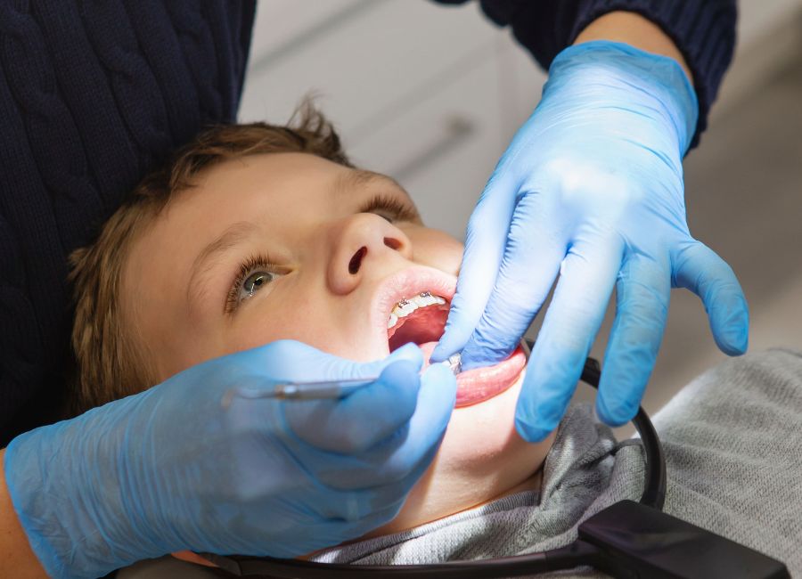 Apparecchio Denti per Bambini: Domande Frequenti dei Genitori