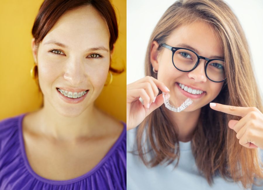 Ortodonzia Tradizionale vs. Ortodonzia Invisibile: Quale Scegliere?